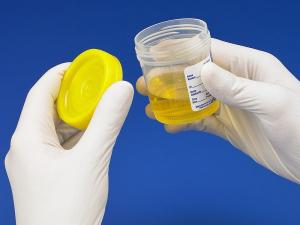 urine sample